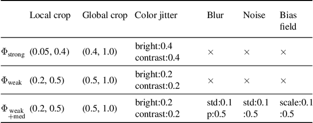 Figure 3 for Enhancing Contrastive Learning for Retinal Imaging via Adjusted Augmentation Scales