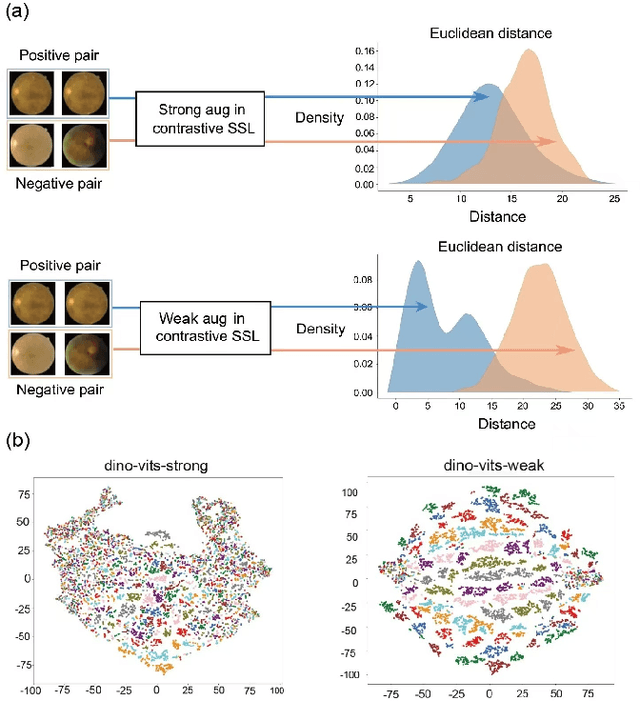 Figure 4 for Enhancing Contrastive Learning for Retinal Imaging via Adjusted Augmentation Scales