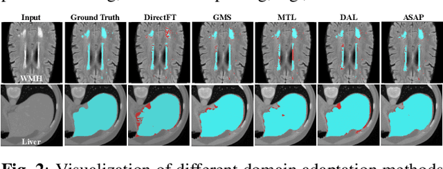 Figure 3 for Adapting Foundation Models for Few-Shot Medical Image Segmentation: Actively and Sequentially