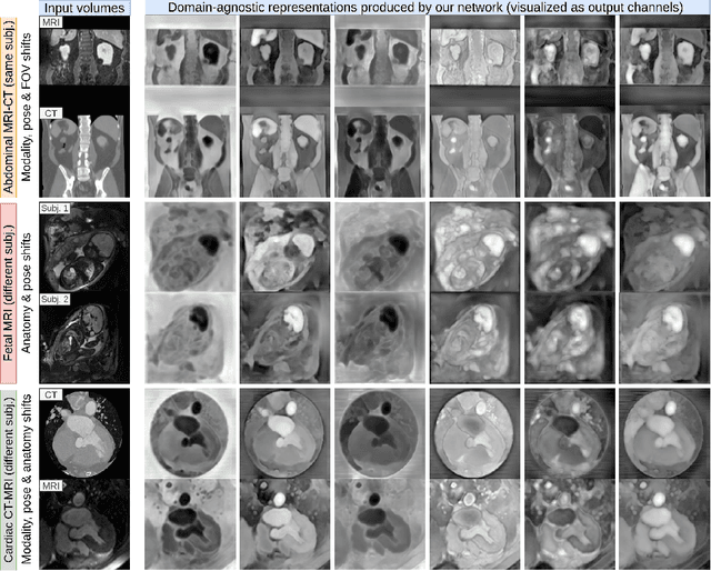 Figure 1 for Learning General-Purpose Biomedical Volume Representations using Randomized Synthesis