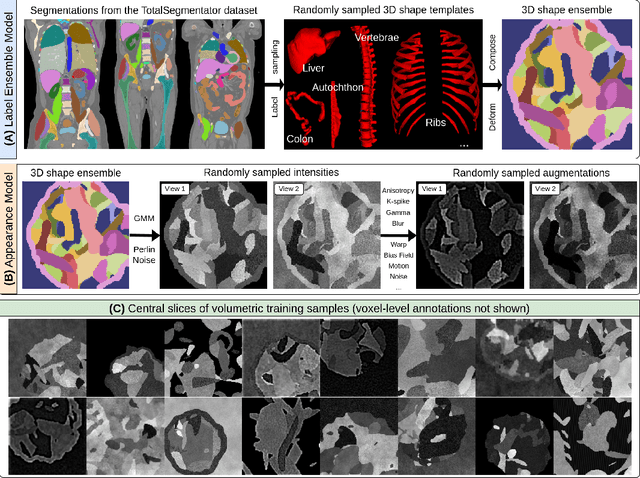 Figure 3 for Learning General-Purpose Biomedical Volume Representations using Randomized Synthesis