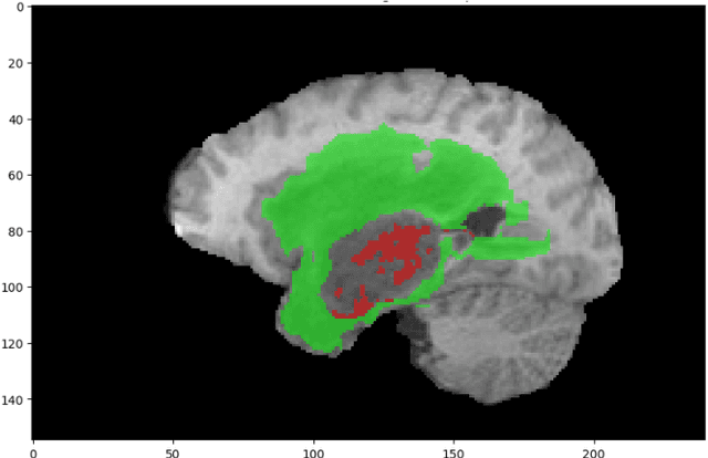 Figure 3 for Region of Interest based Medical Image Compression