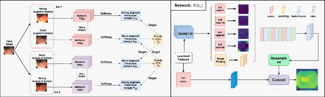 Figure 1 for Semi-supervised Medical Image Segmentation Method Based on Cross-pseudo Labeling Leveraging Strong and Weak Data Augmentation Strategies