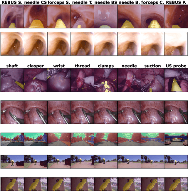 Figure 3 for Correlation-aware active learning for surgery video segmentation