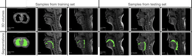 Figure 1 for Open-Source Manually Annotated Vocal Tract Database for Automatic Segmentation from 3D MRI Using Deep Learning: Benchmarking 2D and 3D Convolutional and Transformer Networks