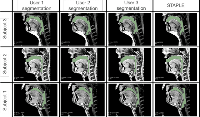 Figure 4 for Open-Source Manually Annotated Vocal Tract Database for Automatic Segmentation from 3D MRI Using Deep Learning: Benchmarking 2D and 3D Convolutional and Transformer Networks