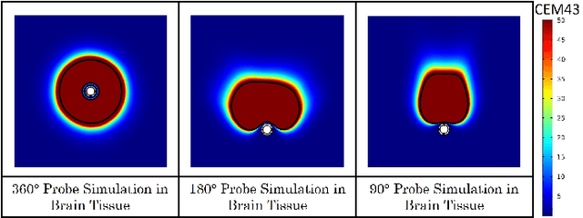 Figure 2 for Deep Brain Ultrasound Ablation Thermal Dose Modeling with in Vivo Experimental Validation