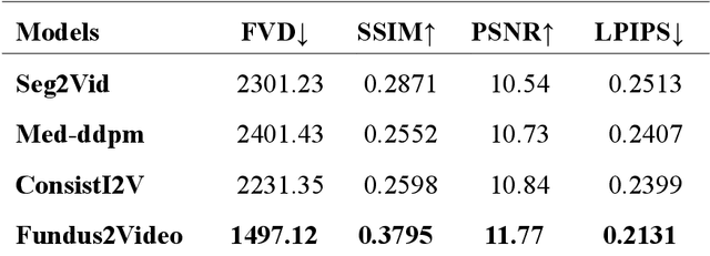 Figure 2 for Fundus to Fluorescein Angiography Video Generation as a Retinal Generative Foundation Model