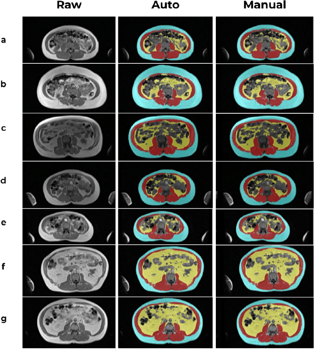 Figure 2 for Automated Body Composition Analysis Using DAFS Express on 2D MRI Slices at L3 Vertebral Level