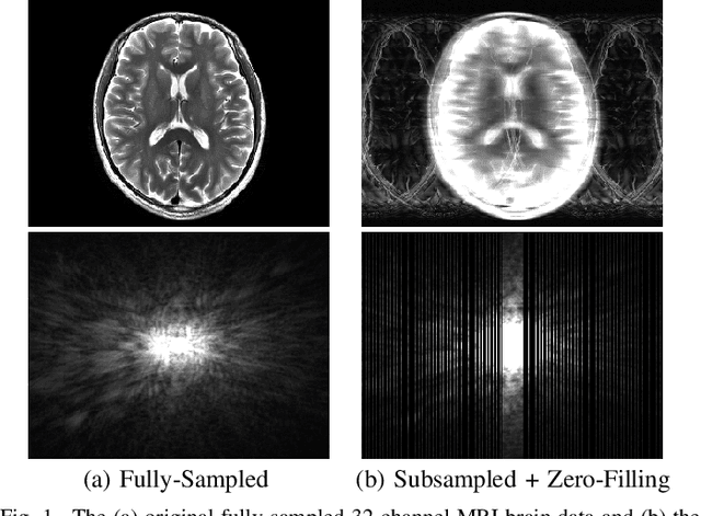 Figure 1 for On Ambiguity in Linear Inverse Problems: Entrywise Bounds on Nearly Data-Consistent Solutions and Entrywise Condition Numbers