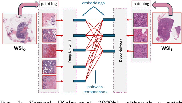 Figure 1 for Aggregation Schemes for Single-Vector WSI Representation Learning in Digital Pathology