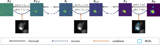 Figure 1 for PGDiffSeg: Prior-Guided Denoising Diffusion Model with Parameter-Shared Attention for Breast Cancer Segmentation