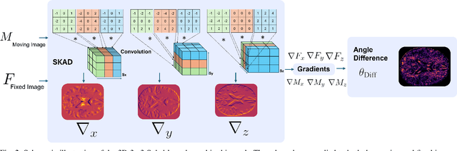 Figure 2 for Efficient Brain Imaging Analysis for Alzheimer's and Dementia Detection Using Convolution-Derivative Operations