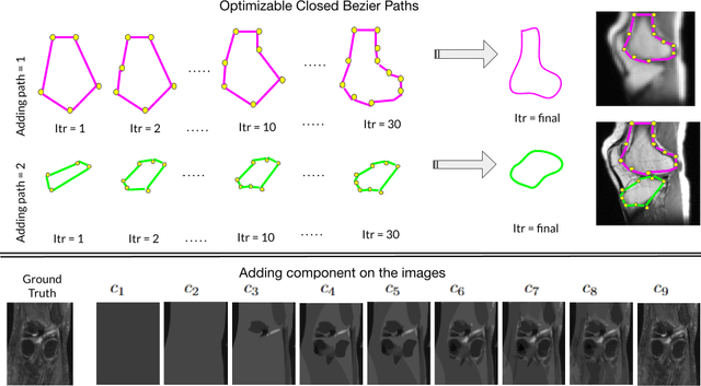 Figure 1 for Denoising via Repainting: an image denoising method using layer wise medical image repainting