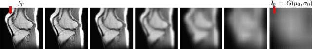 Figure 3 for Denoising via Repainting: an image denoising method using layer wise medical image repainting