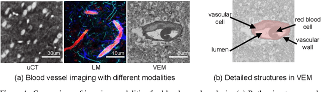 Figure 1 for TriSAM: Tri-Plane SAM for zero-shot cortical blood vessel segmentation in VEM images