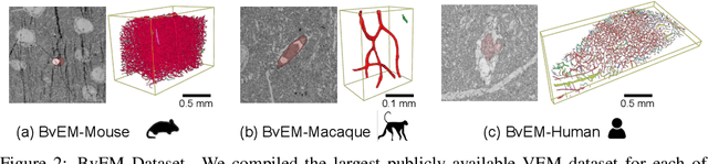 Figure 3 for TriSAM: Tri-Plane SAM for zero-shot cortical blood vessel segmentation in VEM images