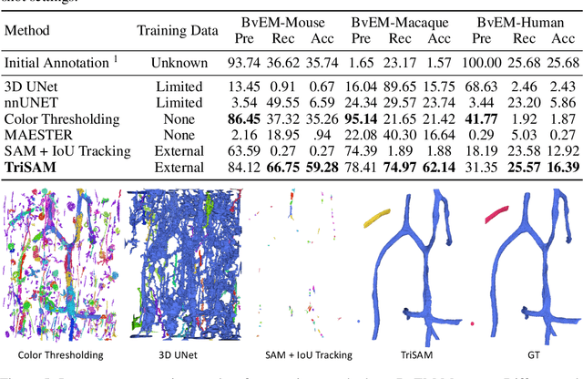 Figure 4 for TriSAM: Tri-Plane SAM for zero-shot cortical blood vessel segmentation in VEM images