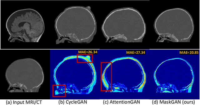 Figure 1 for Structure-Preserving Synthesis: MaskGAN for Unpaired MR-CT Translation