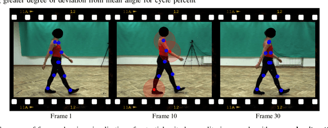 Figure 2 for Developing Normative Gait Cycle Parameters for Clinical Analysis Using Human Pose Estimation