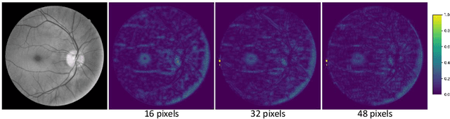 Figure 1 for Gaussian Primitive Optimized Deformable Retinal Image Registration