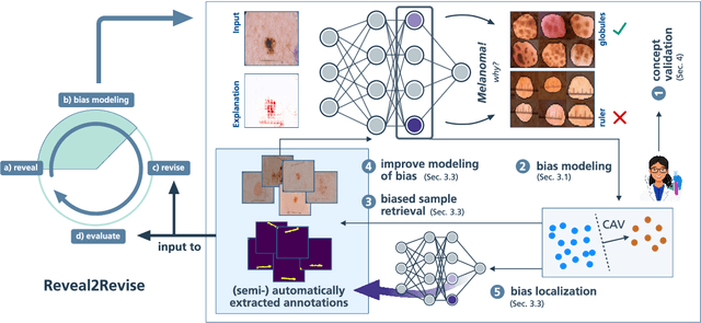 Figure 1 for Ensuring Medical AI Safety: Explainable AI-Driven Detection and Mitigation of Spurious Model Behavior and Associated Data