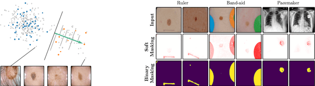 Figure 3 for Ensuring Medical AI Safety: Explainable AI-Driven Detection and Mitigation of Spurious Model Behavior and Associated Data