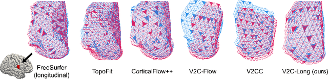 Figure 1 for V2C-Long: Longitudinal Cortex Reconstruction with Spatiotemporal Correspondence