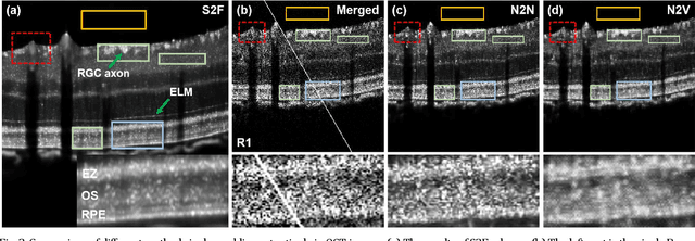 Figure 3 for Sub2Full: split spectrum to boost OCT despeckling without clean data
