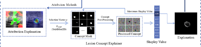 Figure 1 for LCE: A Framework for Explainability of DNNs for Ultrasound Image Based on Concept Discovery