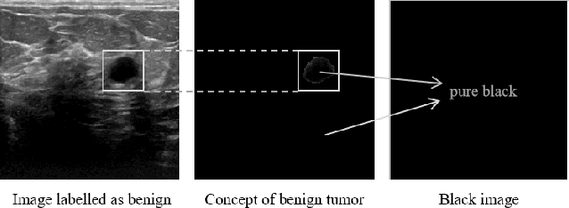 Figure 2 for LCE: A Framework for Explainability of DNNs for Ultrasound Image Based on Concept Discovery