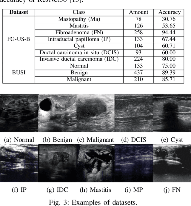 Figure 3 for LCE: A Framework for Explainability of DNNs for Ultrasound Image Based on Concept Discovery