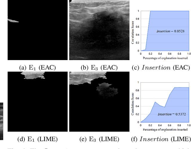 Figure 4 for LCE: A Framework for Explainability of DNNs for Ultrasound Image Based on Concept Discovery