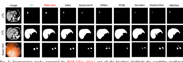 Figure 3 for PAM-UNet: Shifting Attention on Region of Interest in Medical Images