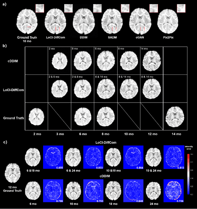 Figure 3 for LoCI-DiffCom: Longitudinal Consistency-Informed Diffusion Model for 3D Infant Brain Image Completion