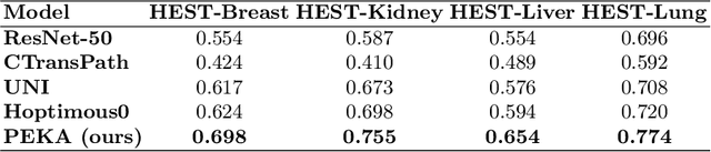 Figure 2 for Teaching pathology foundation models to accurately predict gene expression with parameter efficient knowledge transfer