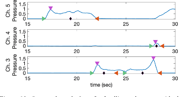 Figure 4 for E-TRoll: Tactile Sensing and Classification via A Simple Robotic Gripper for Extended Rolling Manipulations