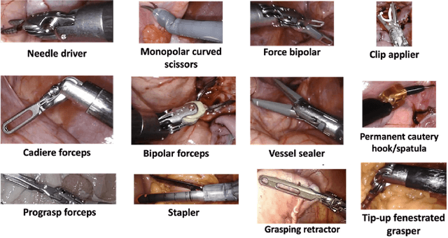 Figure 2 for Surgical Visual Understanding (SurgVU) Dataset