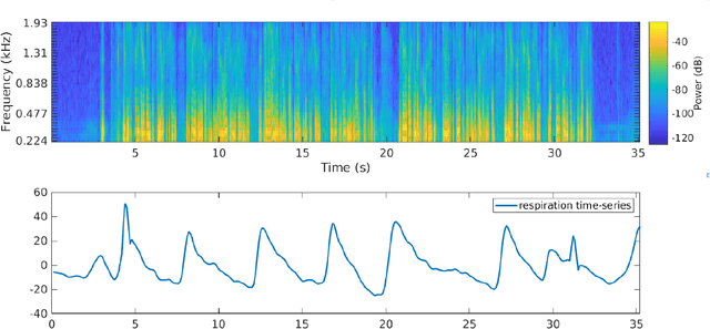 Figure 1 for Pre-Trained Foundation Model representations to uncover Breathing patterns in Speech