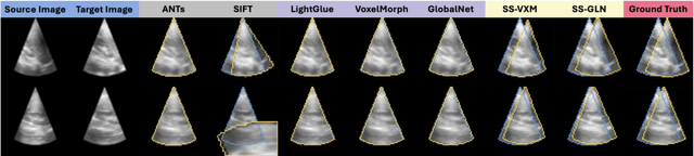 Figure 4 for SynStitch: a Self-Supervised Learning Network for Ultrasound Image Stitching Using Synthetic Training Pairs and Indirect Supervision