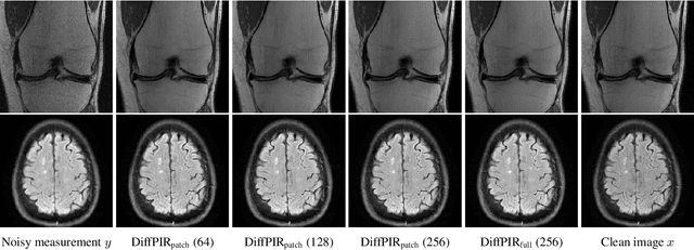Figure 3 for Investigating the Feasibility of Patch-based Inference for Generalized Diffusion Priors in Inverse Problems for Medical Images