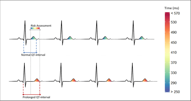 Figure 1 for Contrasting Attitudes Towards Current and Future AI Applications for Computerised Interpretation of ECG: A Clinical Stakeholder Interview Study