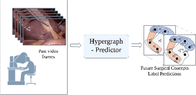 Figure 1 for Hypergraph-Transformer (HGT) for Interactive Event Prediction in Laparoscopic and Robotic Surgery