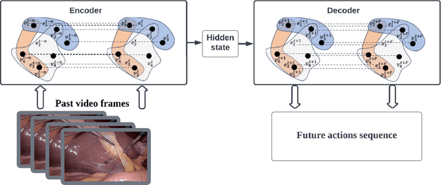 Figure 3 for Hypergraph-Transformer (HGT) for Interactive Event Prediction in Laparoscopic and Robotic Surgery