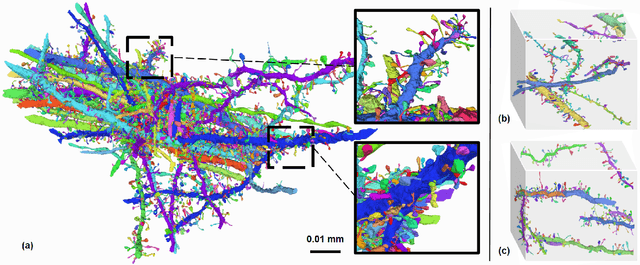 Figure 4 for FreSeg: Frenet-Frame-based Part Segmentation for 3D Curvilinear Structures