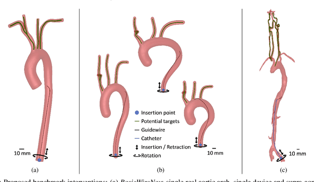 Figure 3 for Learning-Based Autonomous Navigation, Benchmark Environments and Simulation Framework for Endovascular Interventions