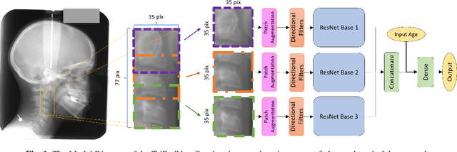 Figure 1 for Classification of the Cervical Vertebrae Maturation (CVM) stages Using the Tripod Network