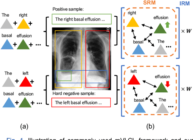 Figure 1 for Enhancing medical vision-language contrastive learning via inter-matching relation modelling