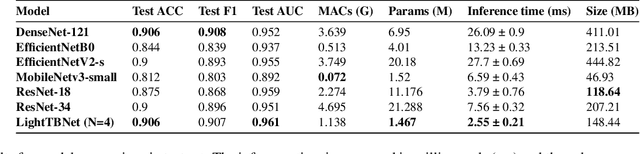 Figure 3 for A Lightweight, Rapid and Efficient Deep Convolutional Network for Chest X-Ray Tuberculosis Detection