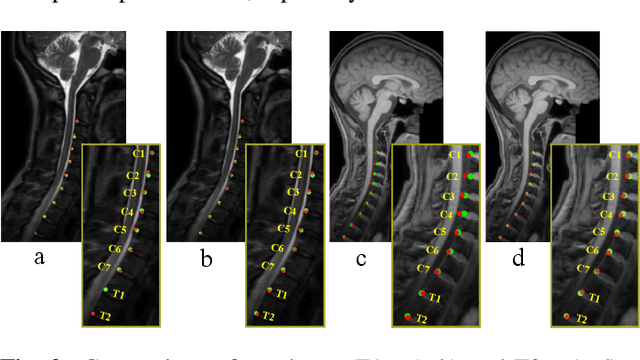 Figure 3 for HCA-Net: Hierarchical Context Attention Network for Intervertebral Disc Semantic Labeling